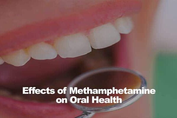 Close-up of a person's mouth with dental mirror and text Effects of Methamphetamine on Oral Health.