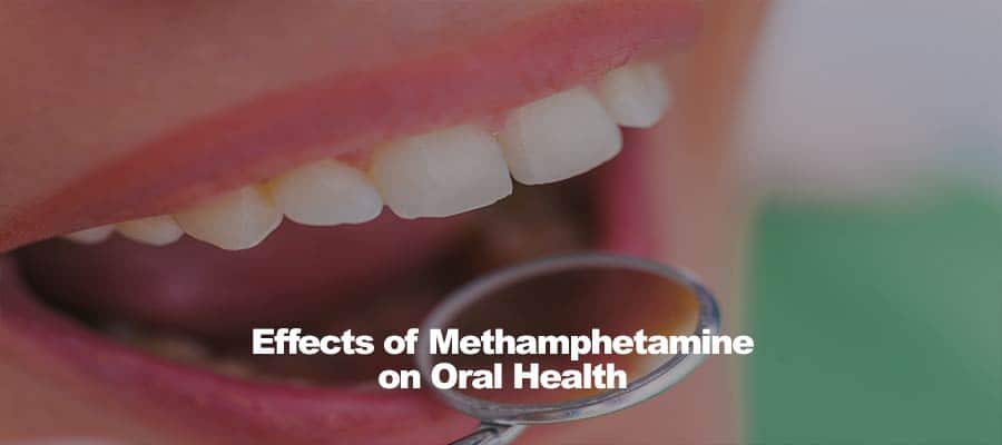 Close-up of a person's mouth with dental mirror and text Effects of Methamphetamine on Oral Health.