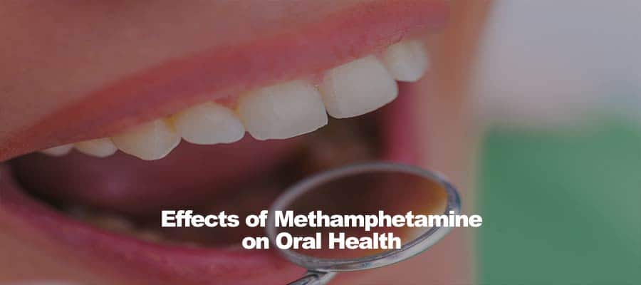 Effects of Methamphetamine on Oral Health