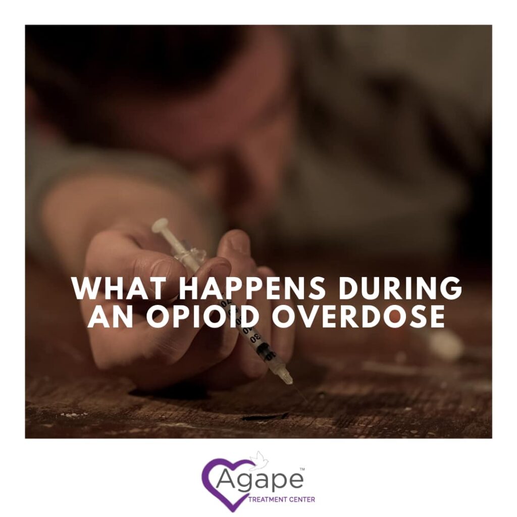 What Happens During an Opioid Overdose