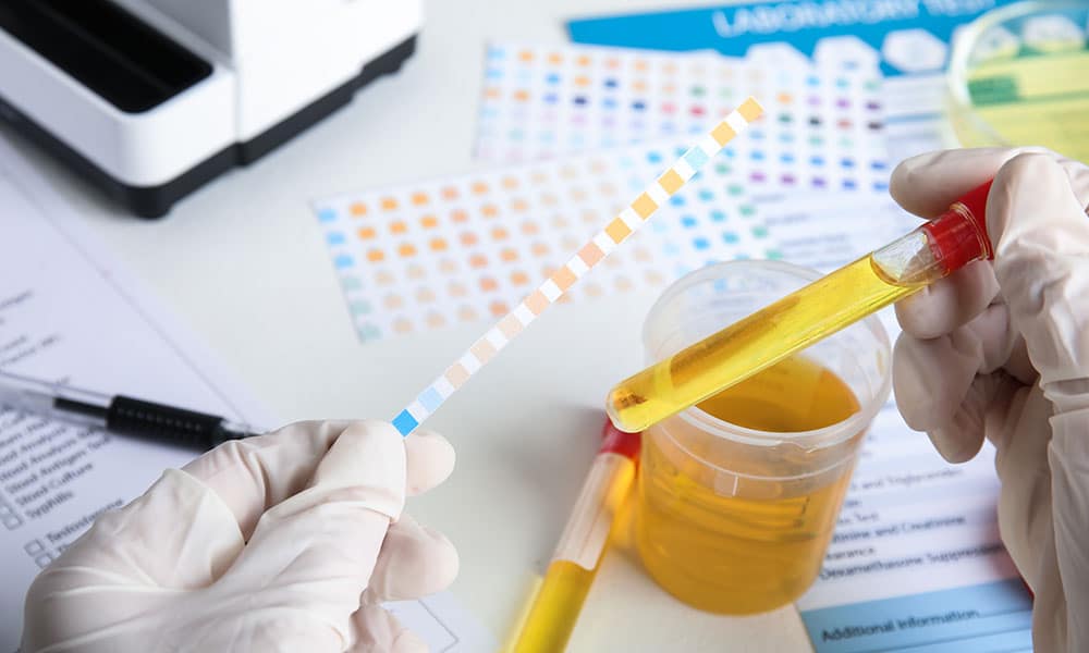 Detection Times for Lorazepam on Drug Tests